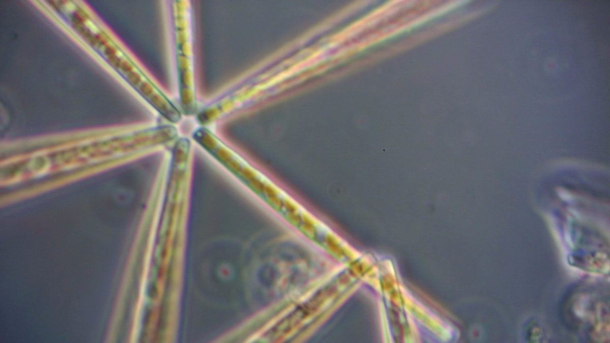 Mikroskopische Ansicht von Algen